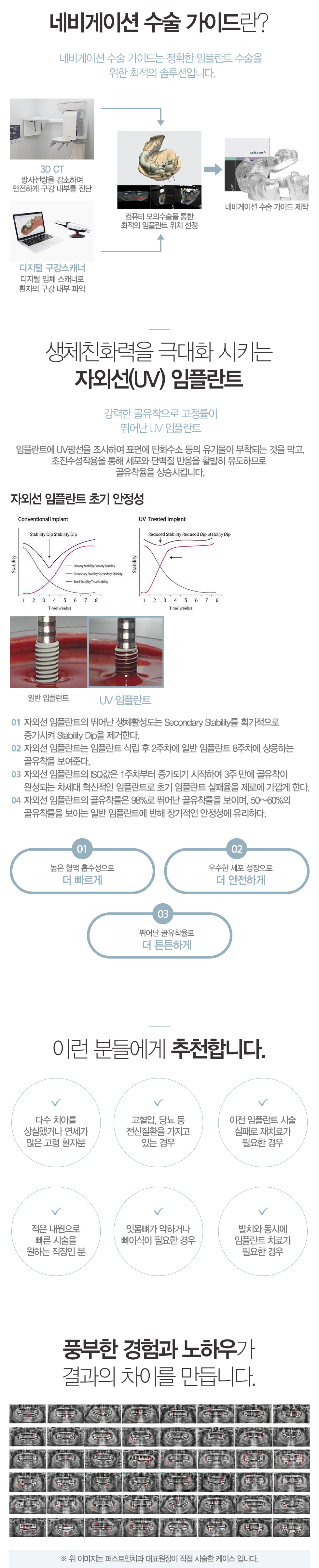 임플란트 클리닉
