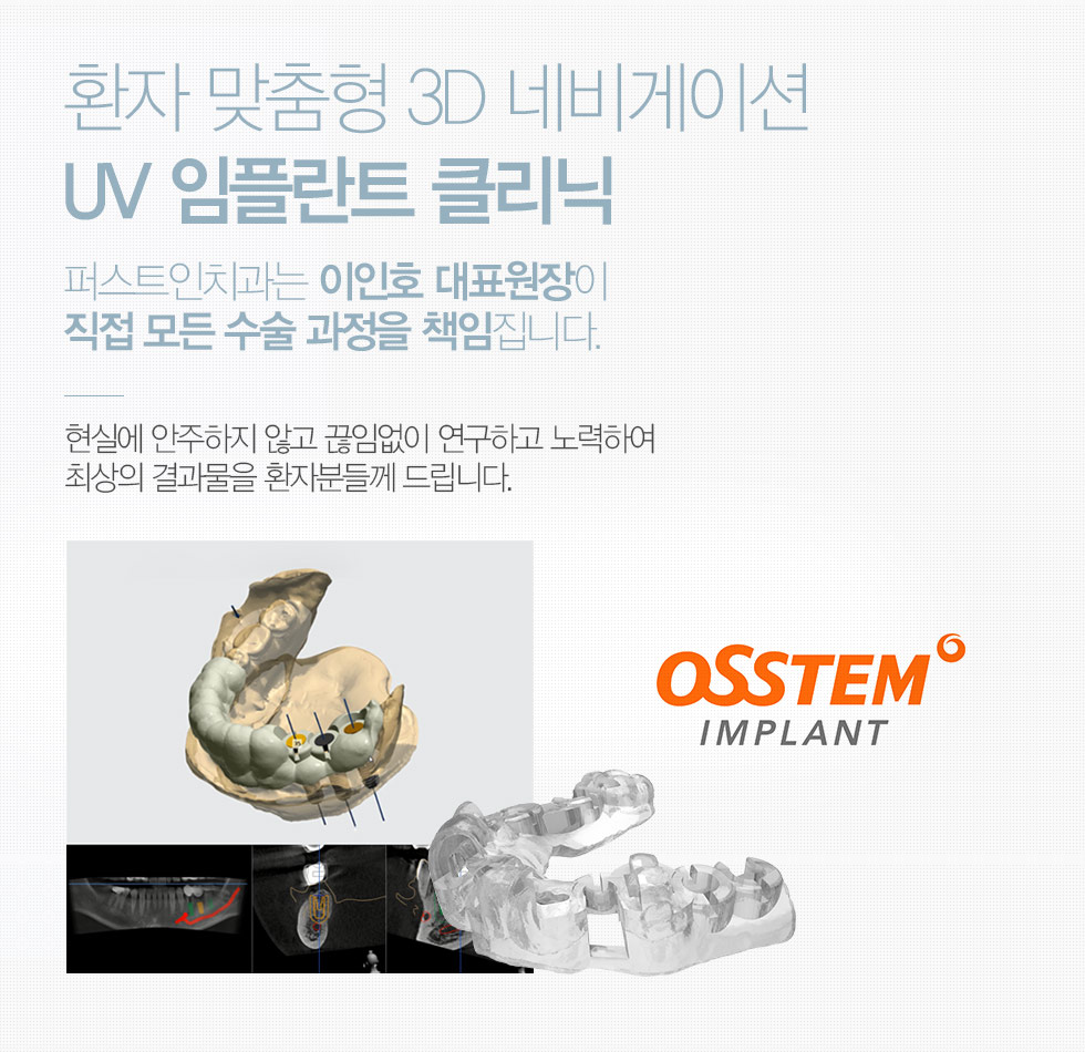 환자 맞춤형 3D 네비게이션 UV 임플란트 클리닉