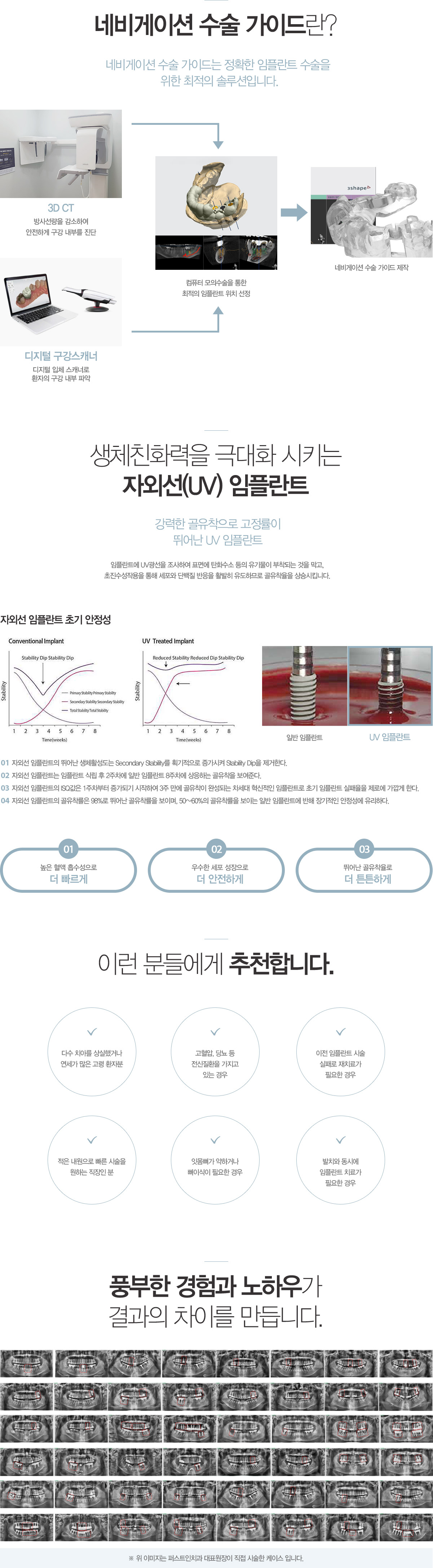 임플란트 클리닉